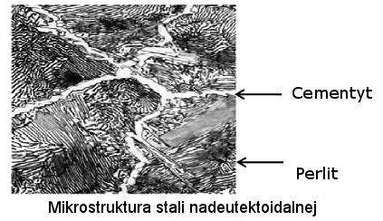 Mikrostruktura_stali_nadeutektoidalnej